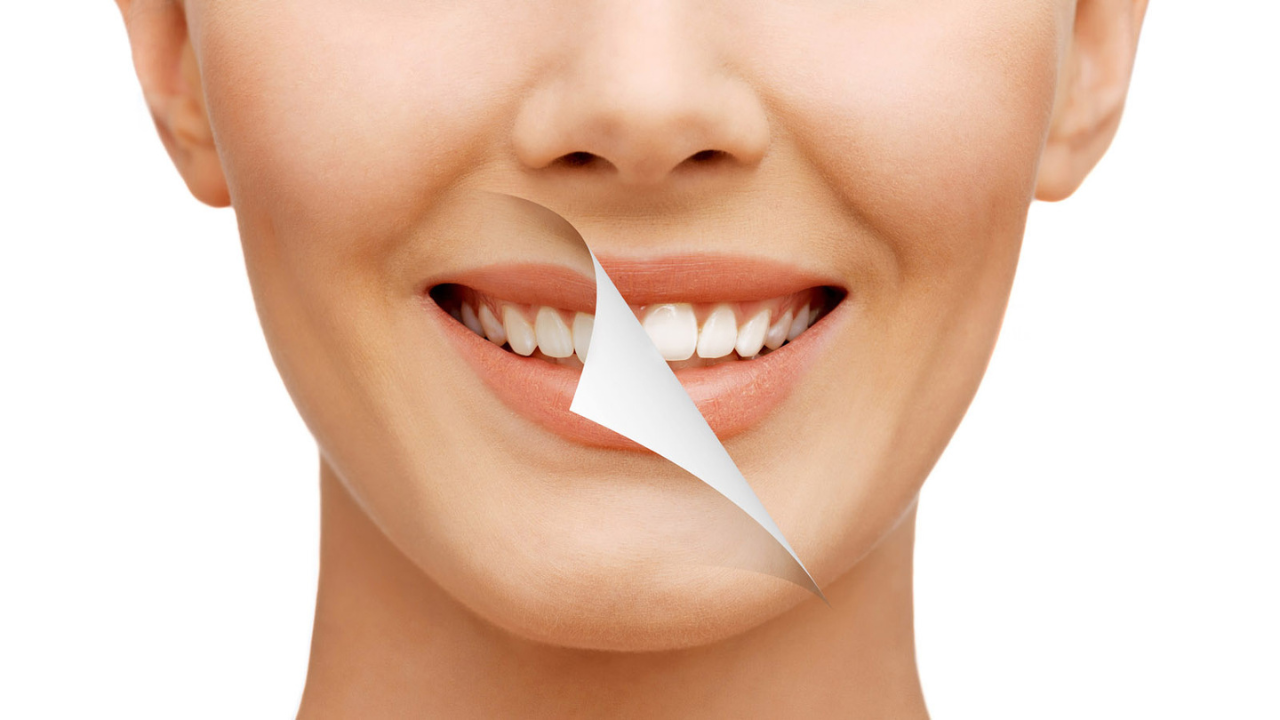 How Can I Maintain My Smile after Smile Design Procedure?